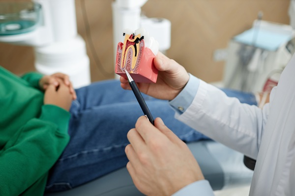 Indications For A Root Canal: What To Look Out For